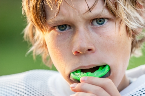 Custom Fitted Mouthguards by DenturePoint