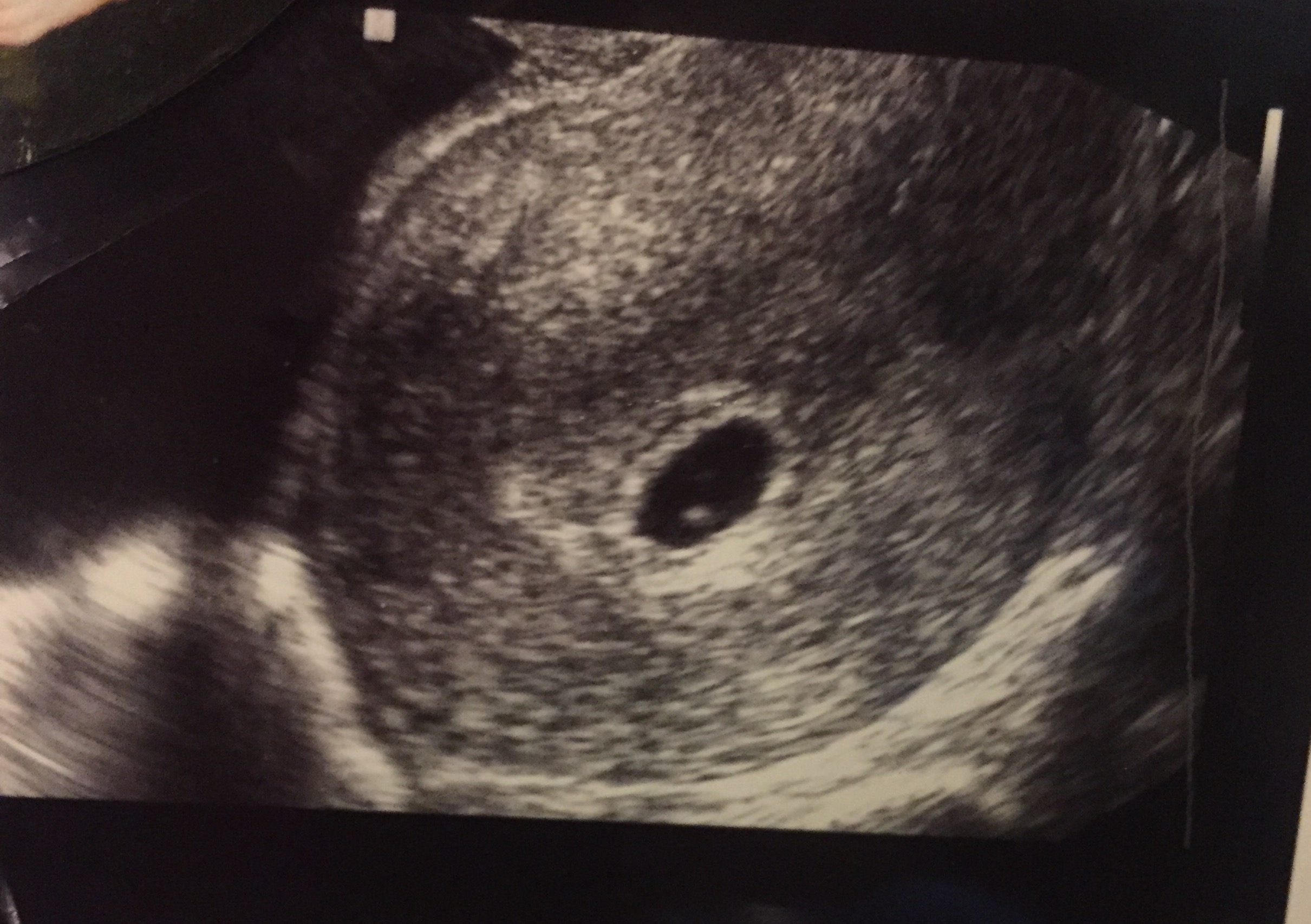 Baby J's first ultrasound at 6 weeks. Baby is the little white dot in the middle. I don't have the 8 week ultrasound photo, but it blew my mind how much Baby grew in two weeks . 