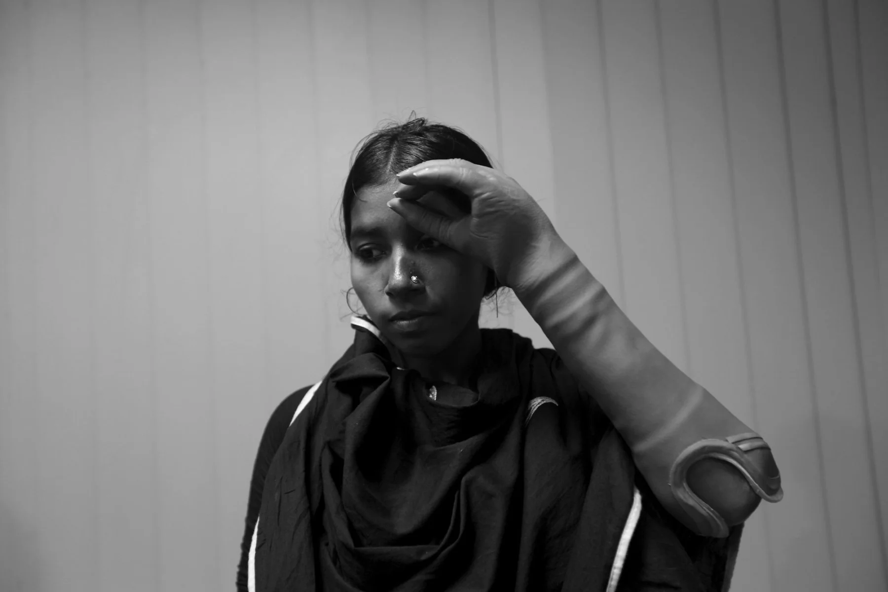 Morium Begum is one of the eleven Rana Plaza survivors who lost their arms and legs during the building collapse in Bangladesh on 24 April 2013, Photo: Abir Abdullah
