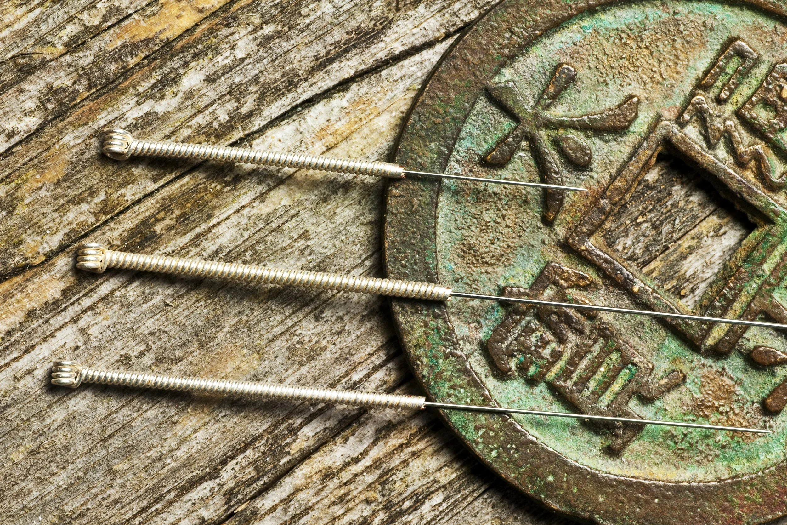 colchester-acupuncture-leave-feedback-header.jpg