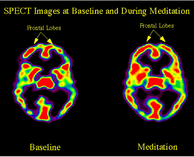 Meditation has been shown to produce significant increases in left-sided anterior brain activity, which is associated with positive emotional states like happiness. 