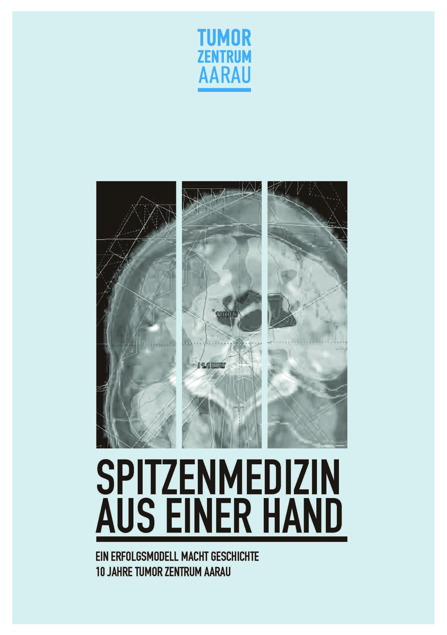 Textredaktion Jubiläumsbroschüre I Tumor Zentrum Aarau