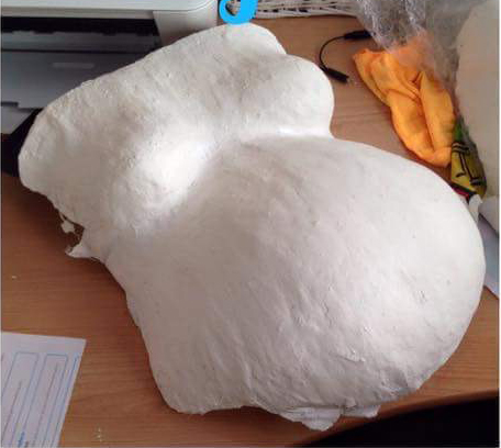  2nd low definition belly cast made from DIY kit 