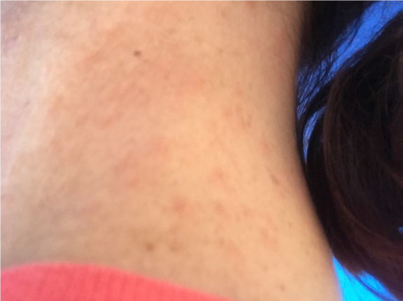 Oy! My neck!