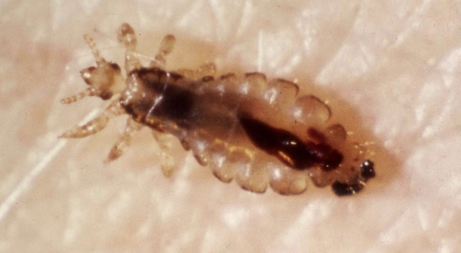 Dr.Z's Lice Free Picture of Lice.png