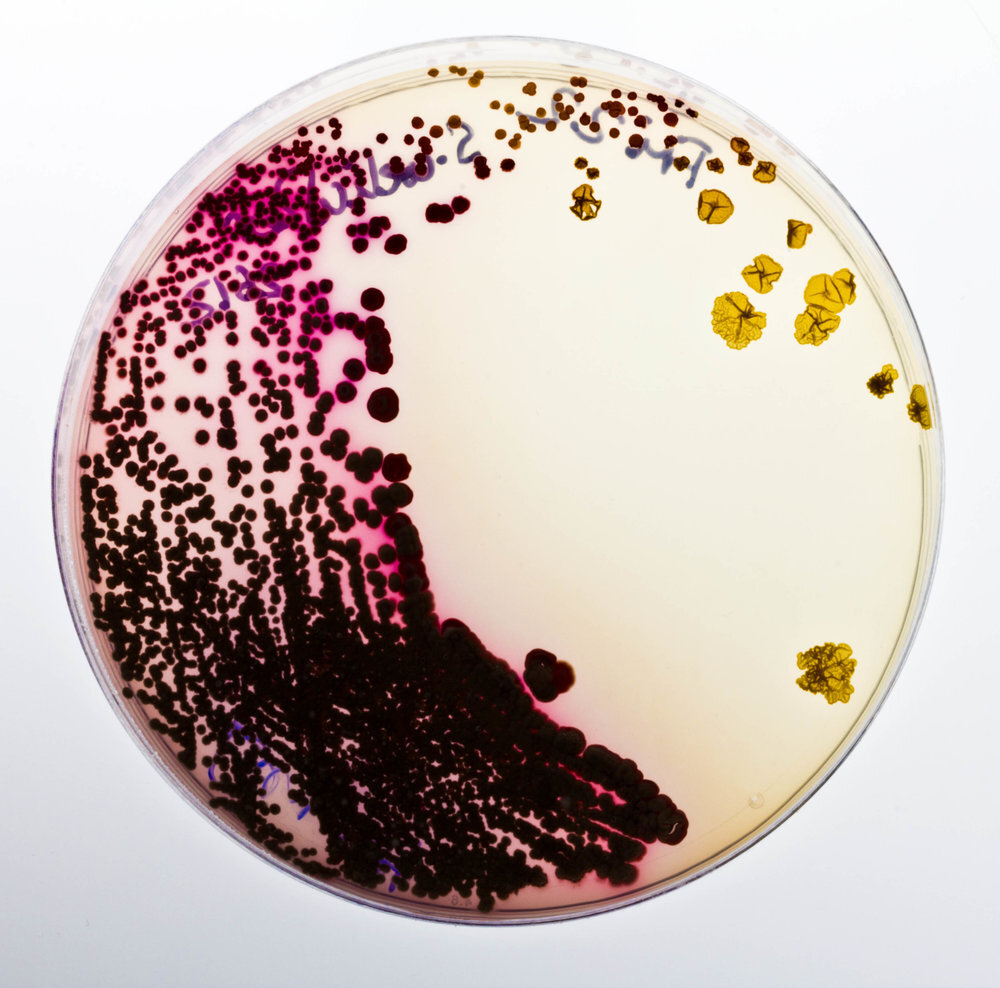 Serratia Marcescens bacteria
