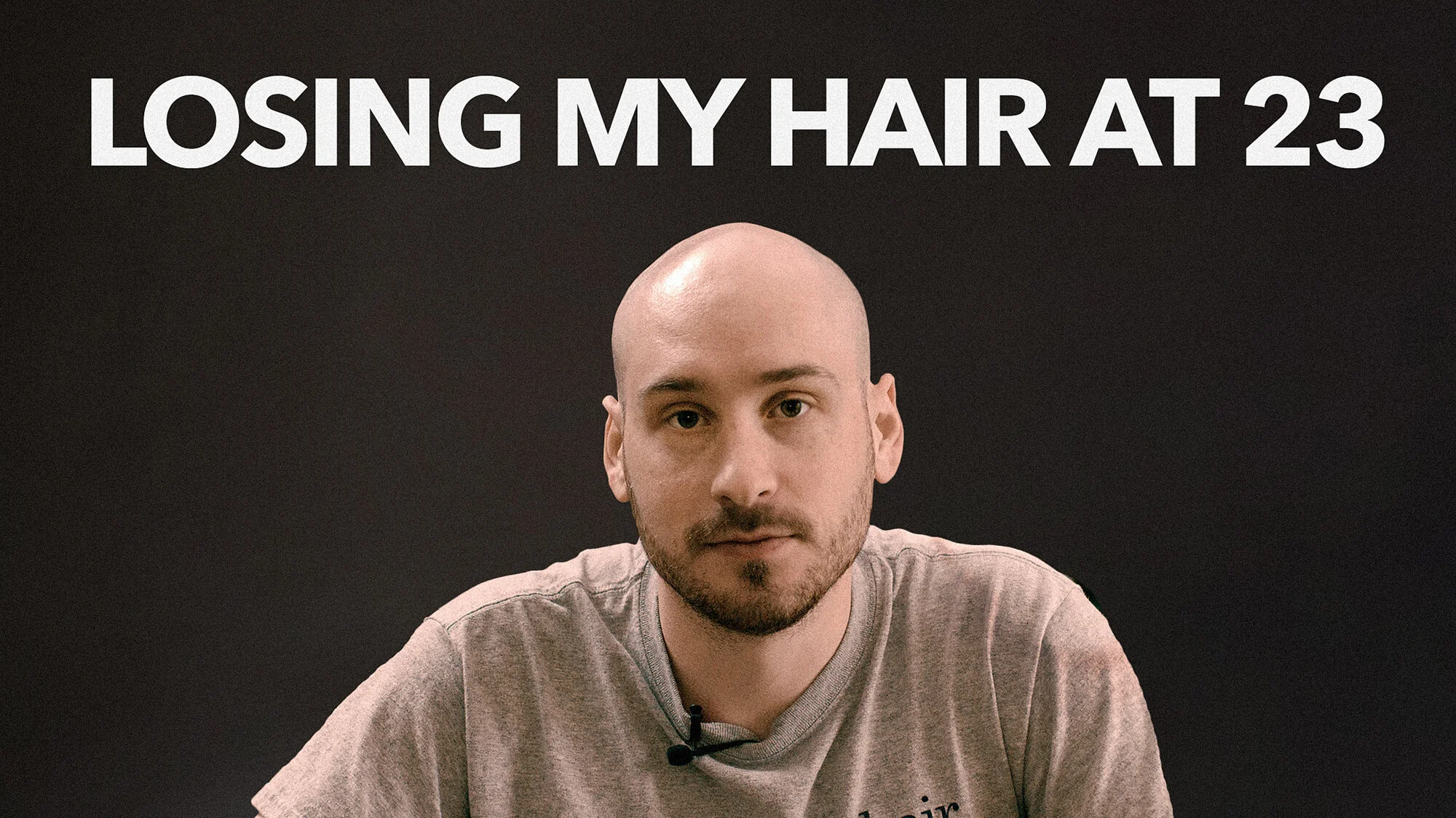 To those dealing with hair loss [VIDEO]