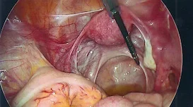 Normal-pelvis.jpg