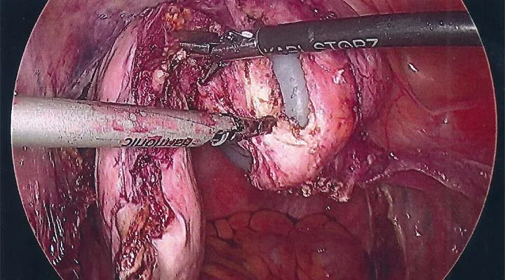 case 5-2.jpg