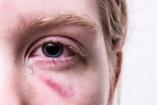 episode one hundred and eight: what is trauma?