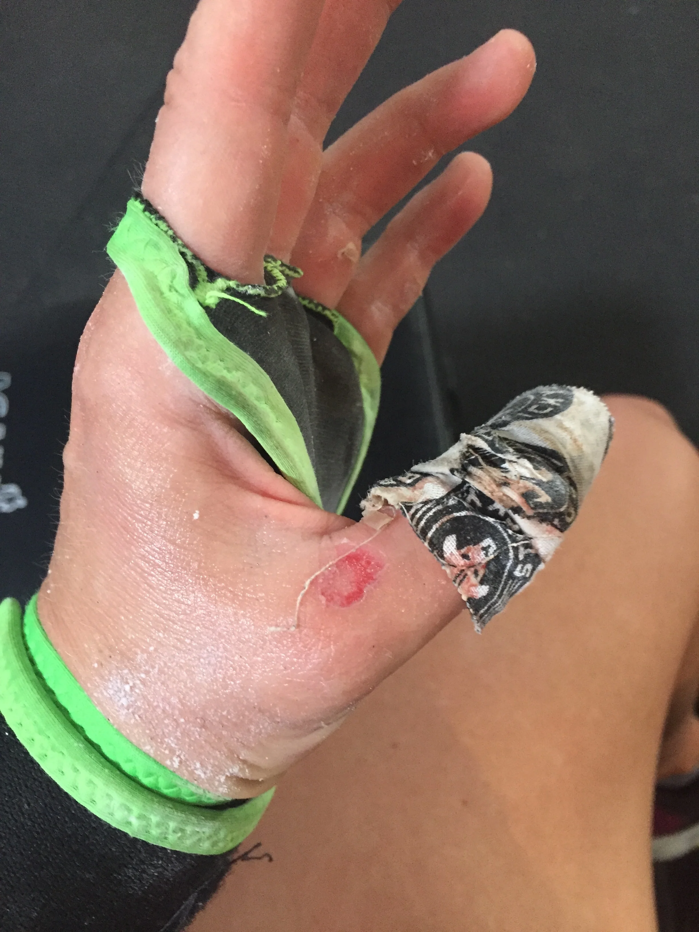 RIP thumb. I mean, through the tape?!?! Seriously??? 