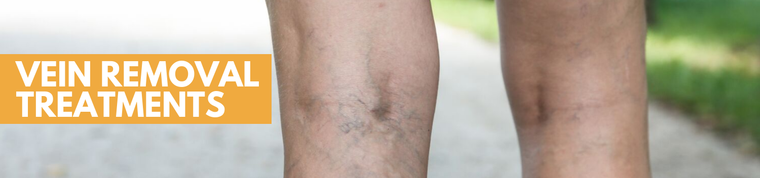VARICOSE AND SPIDER VEINS SCLEROTHERAPY TREATMENT at La Boussole