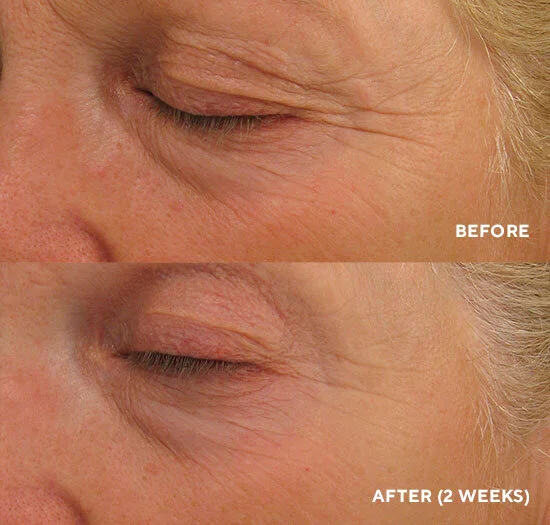 eye authority hydropeptide