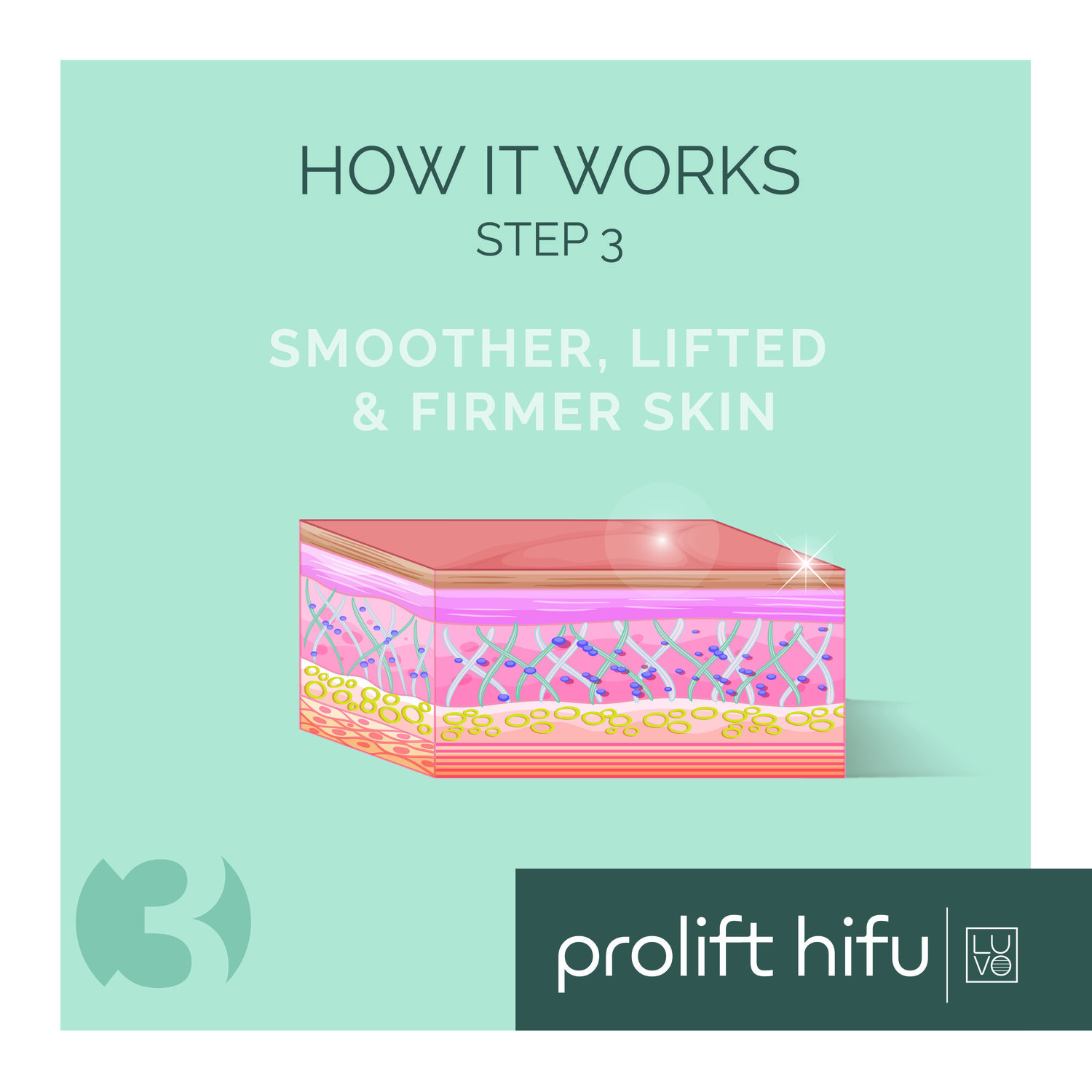 PROLIFT+HIFU_How+It+Works_3.jpg?format=1500w