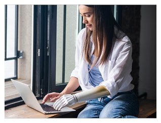 Woman with prosthetic limb working on laptop