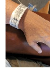 Photograph of patient in bed wearing medical bracelet on their wrist.
