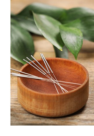 Photograph of several acupuncture pins on a table in a dish container.