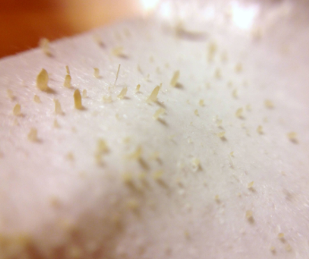 Sebaceous filament on a pore strip