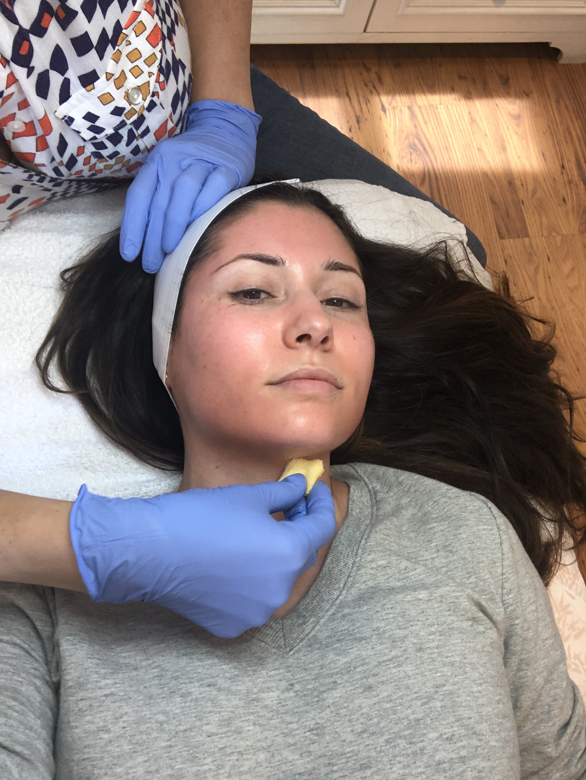 Tina applying the peel to my skin.