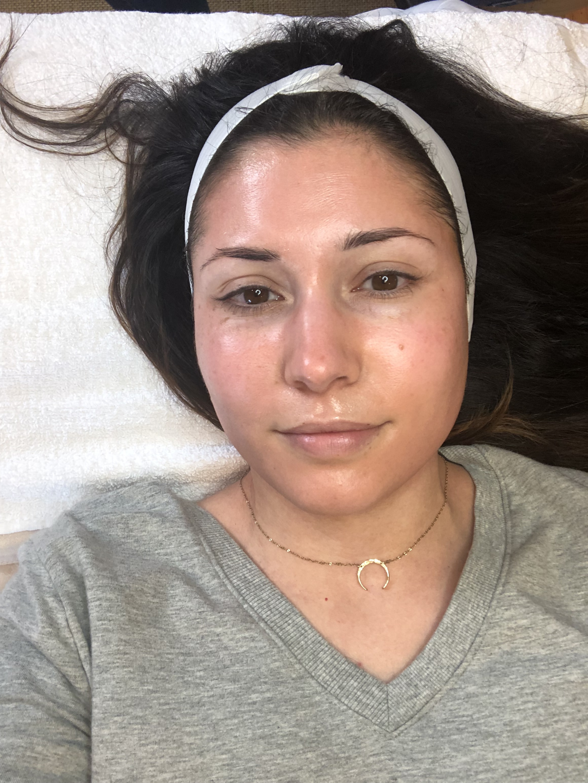 Right after application - slightly pink.
