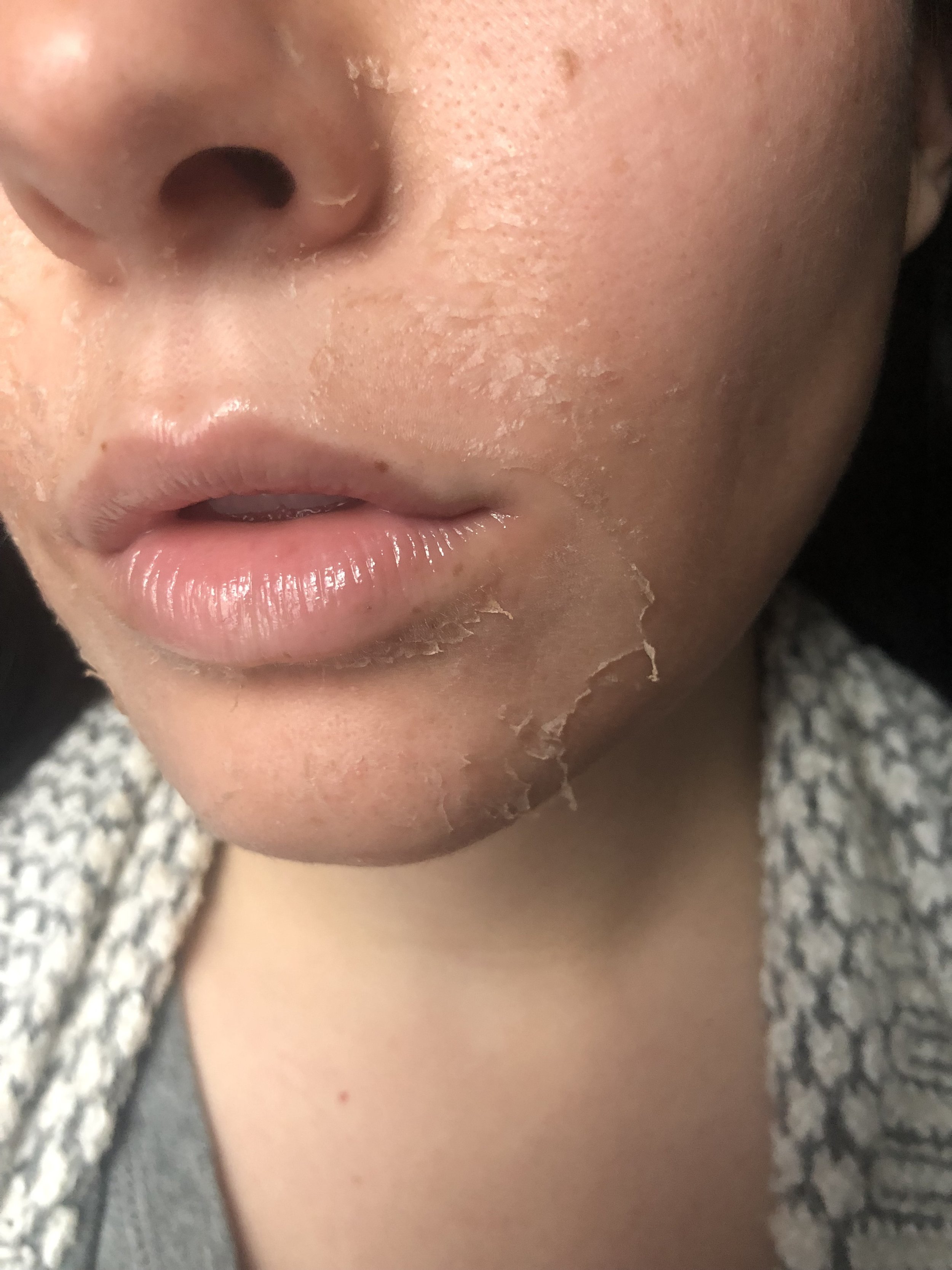 Day 4