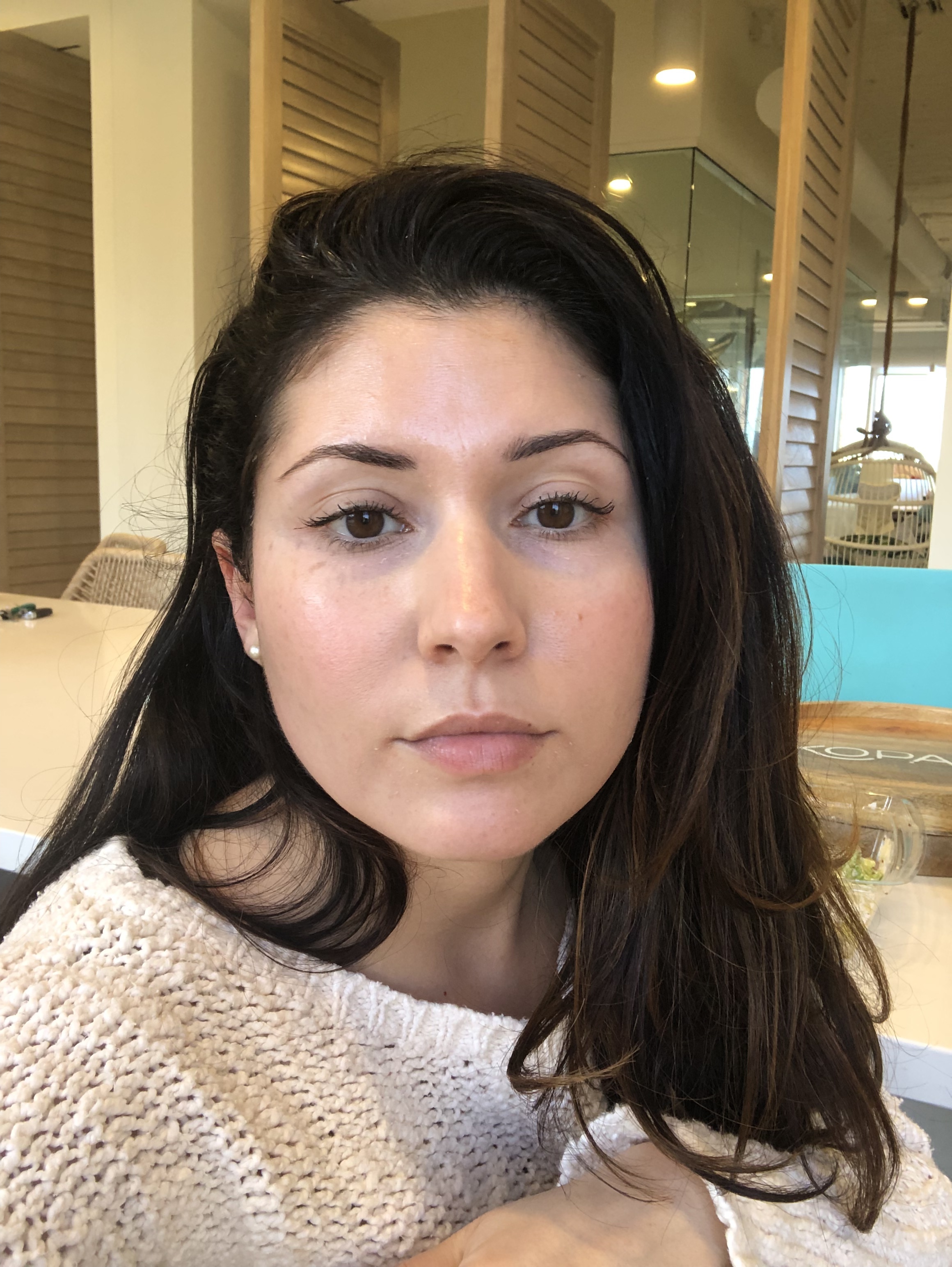 Day 7 - I am still a little dry and flakey around my eyes and the corners of my mouth. But my skin it SO creamy and glowy! I have on moisturizer, SPF and a little mascara.