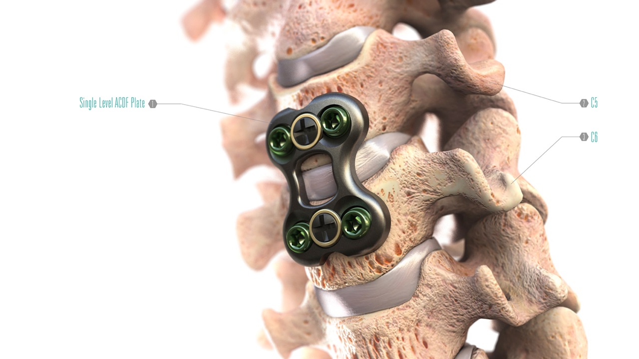 Medtronic Spine App Find information by using the spine as your guide. Pull up videos and images for products and techniques. 