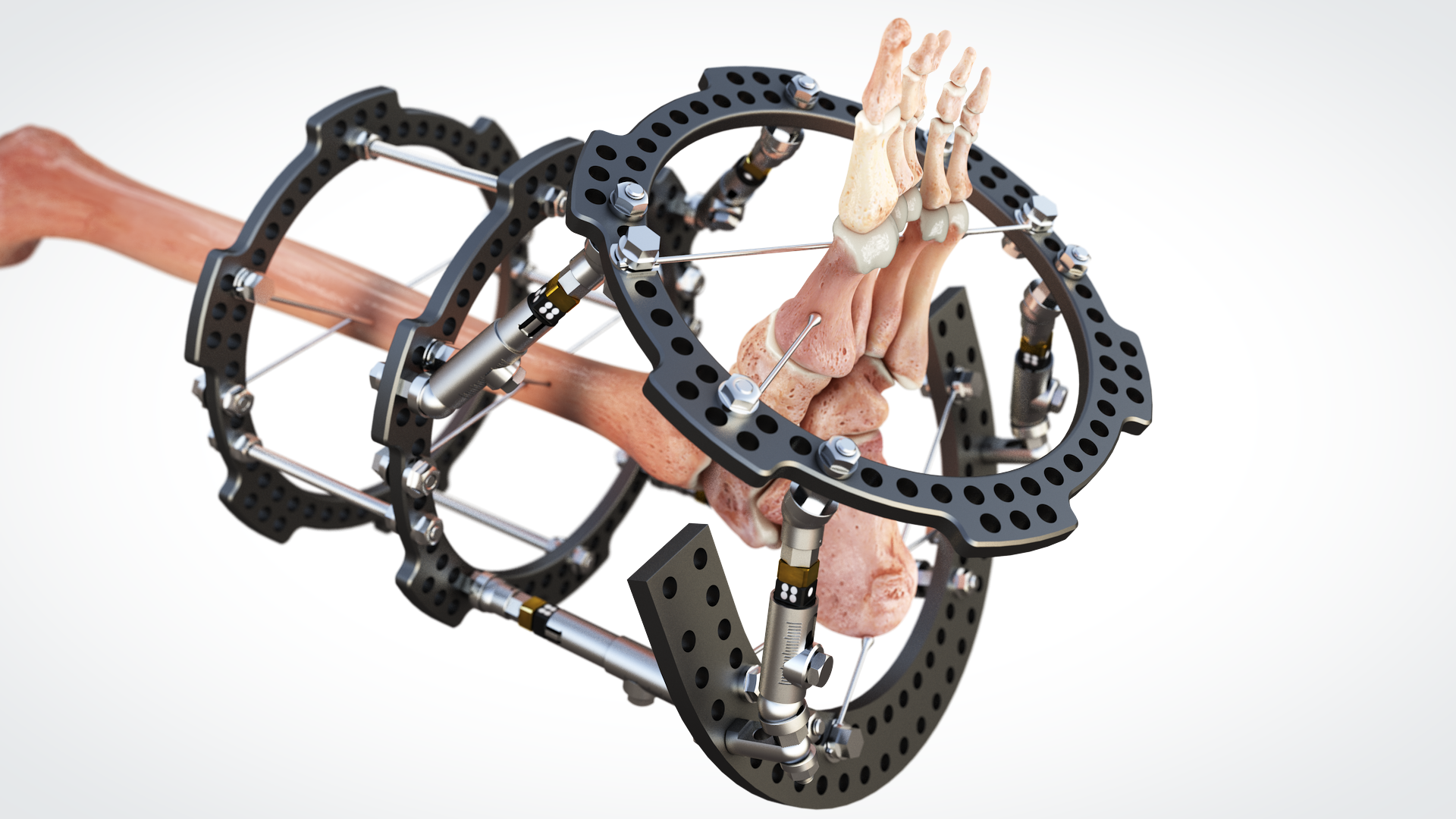 DynamicStrut3120.png
