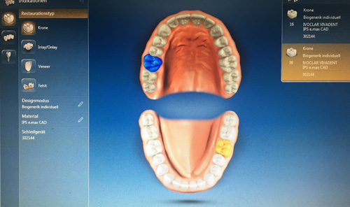 Circona CAD/CAM-System