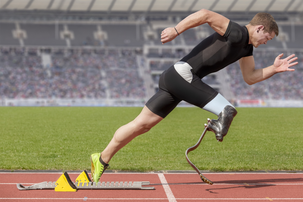 beacon prosthetics and orthotics, man with prosthetic leg