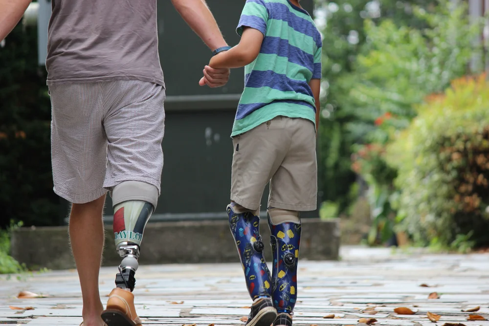 Beacon Prosthetics and Orthotics - man and boy with prosthetic legs, pediatric orthotics, below the knee prosthetics, lower extremity orthotics, prosthetics raleigh nc, spinal bracing