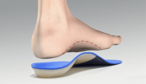 Functional Foot Orthoses