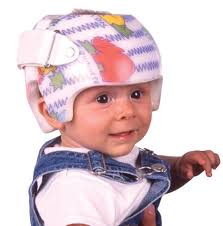 Cranial Remodeling Helmet