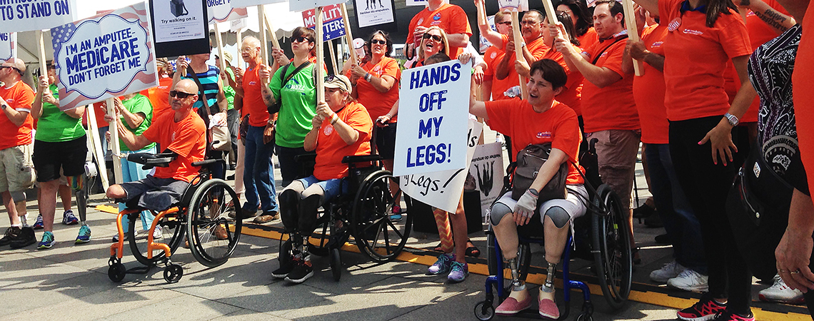 Beacon Prosthetics and Orthotics, prosthetic legs, below knee prosthesis, above the knee prosthetics