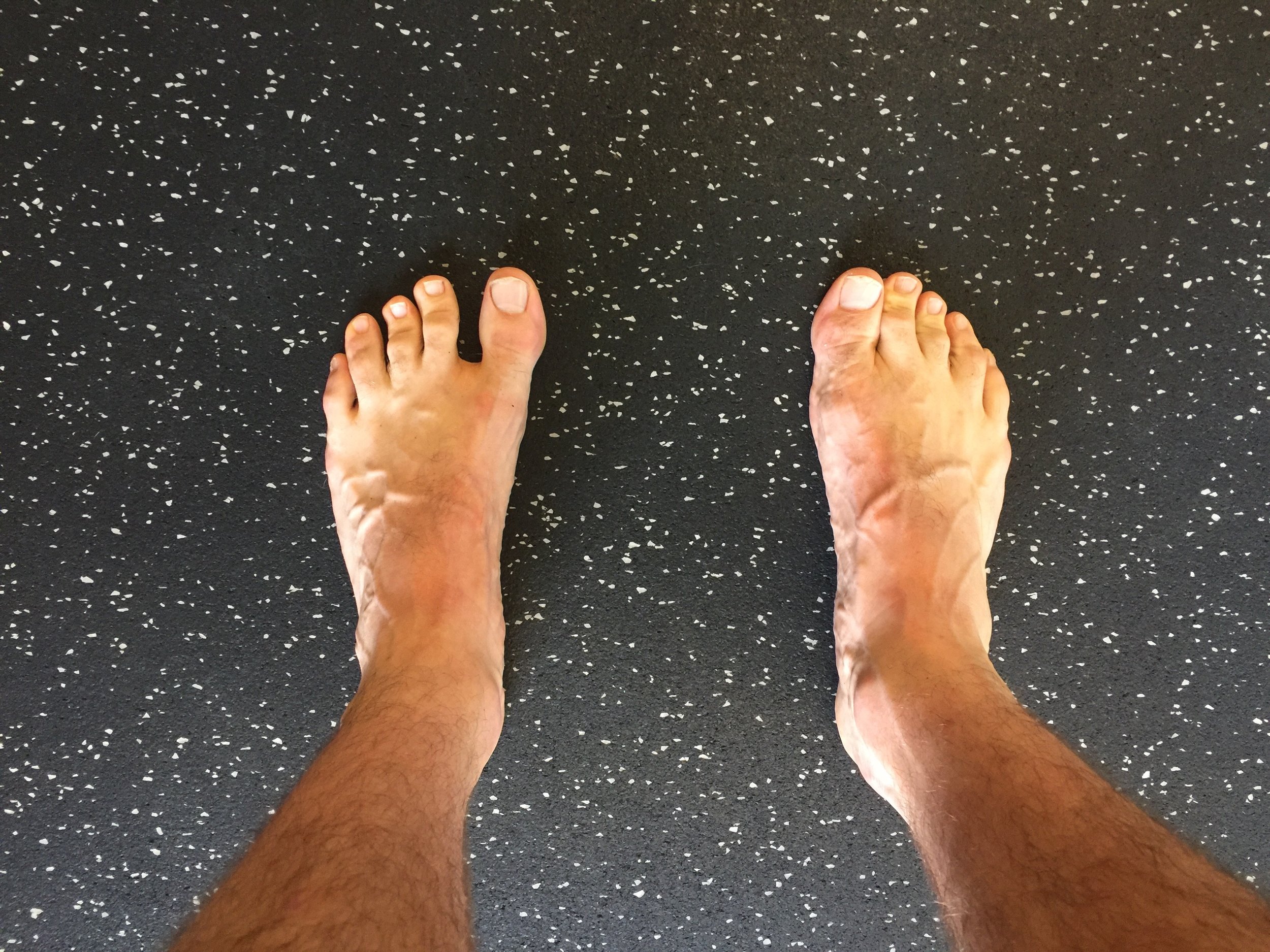 Vivobarefoot - Feet wrecked by 'normal' shoes vs. healthy