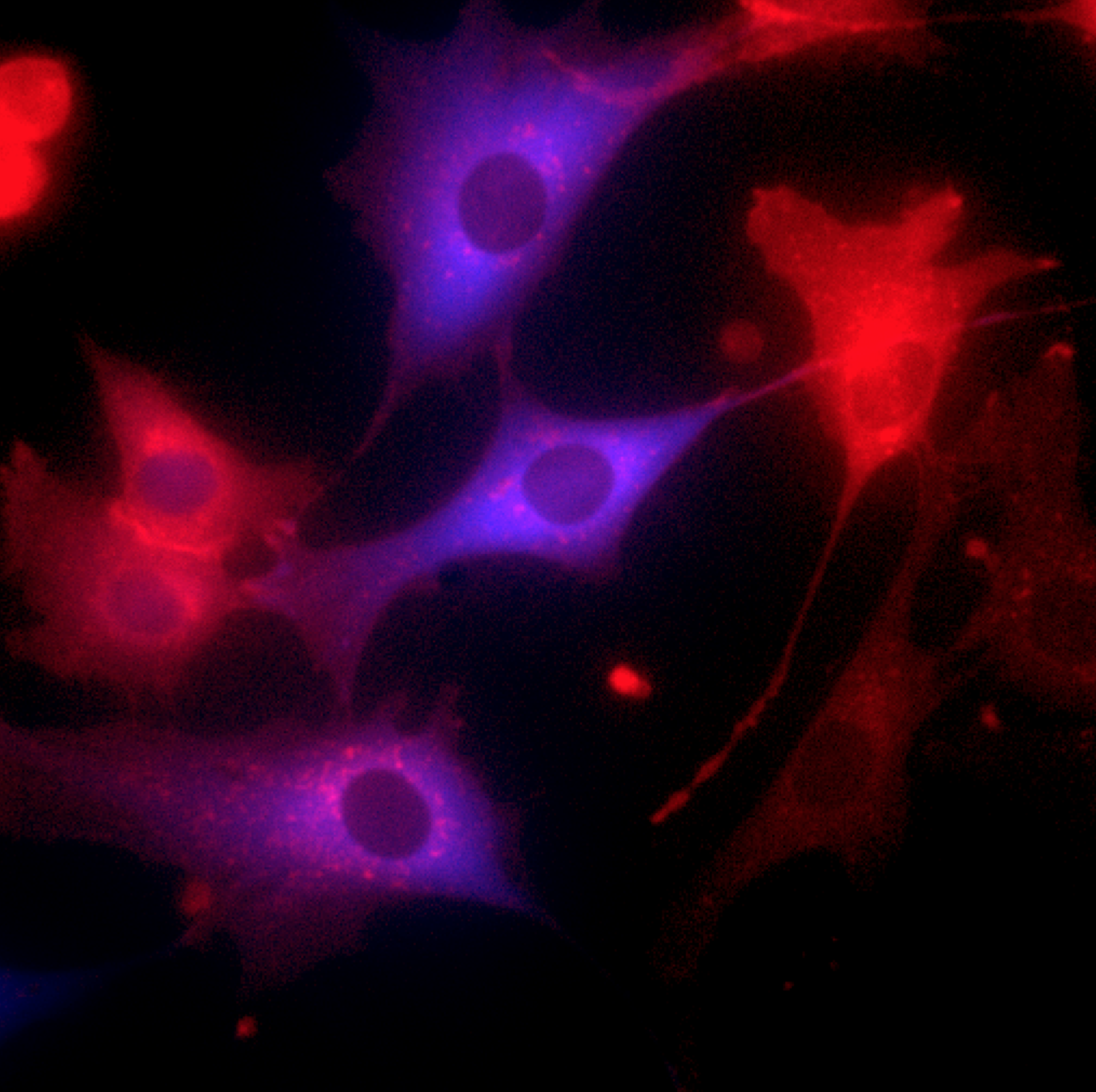 Isogenic population of human cells responding to targeted therapy. Individual cells activate alternative response programs (red and blue fluorescent reporters).