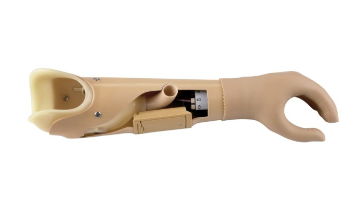 Myoelectric Below-Elbow Prosthesis