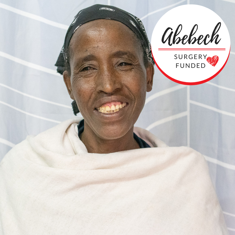 Abebech