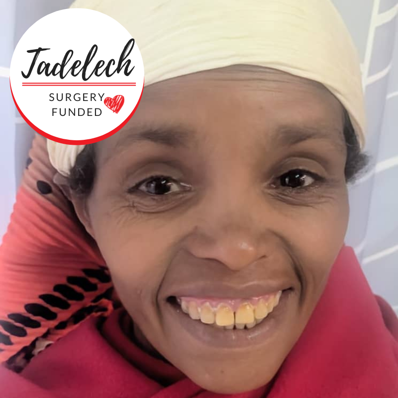 Surgery Funded - Tadelech.png