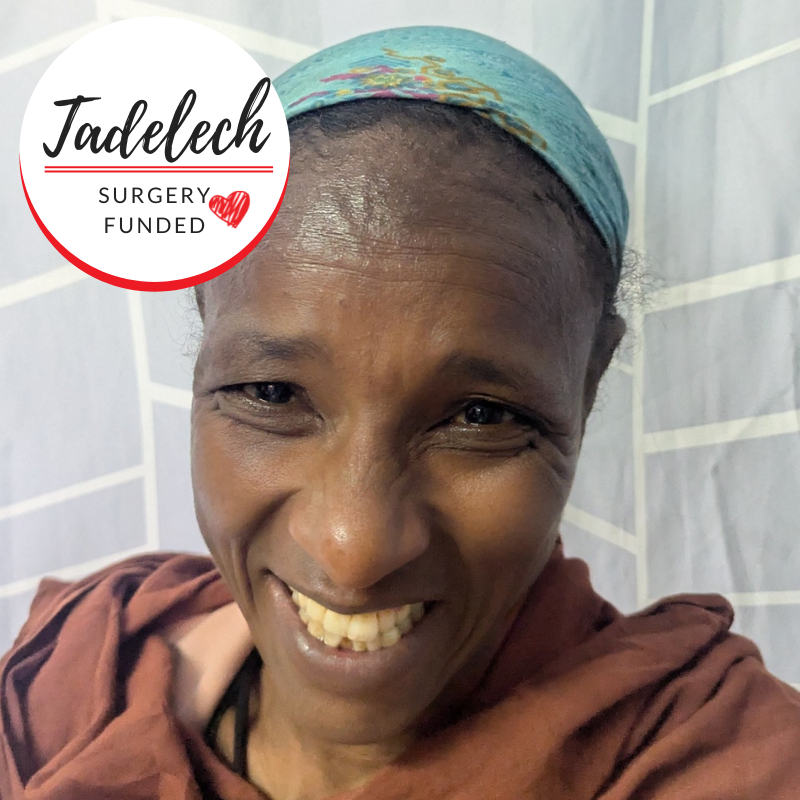 Tadelech