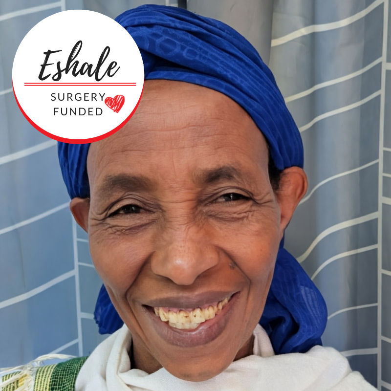 Eshale