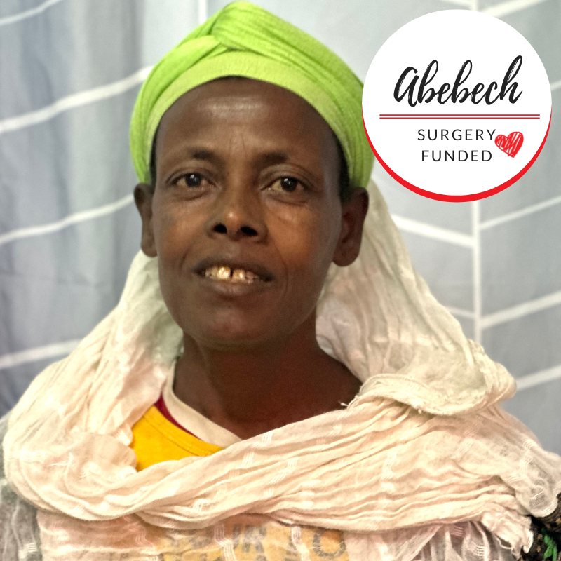 Abebech