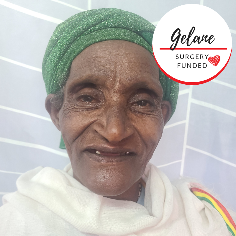 Gelane