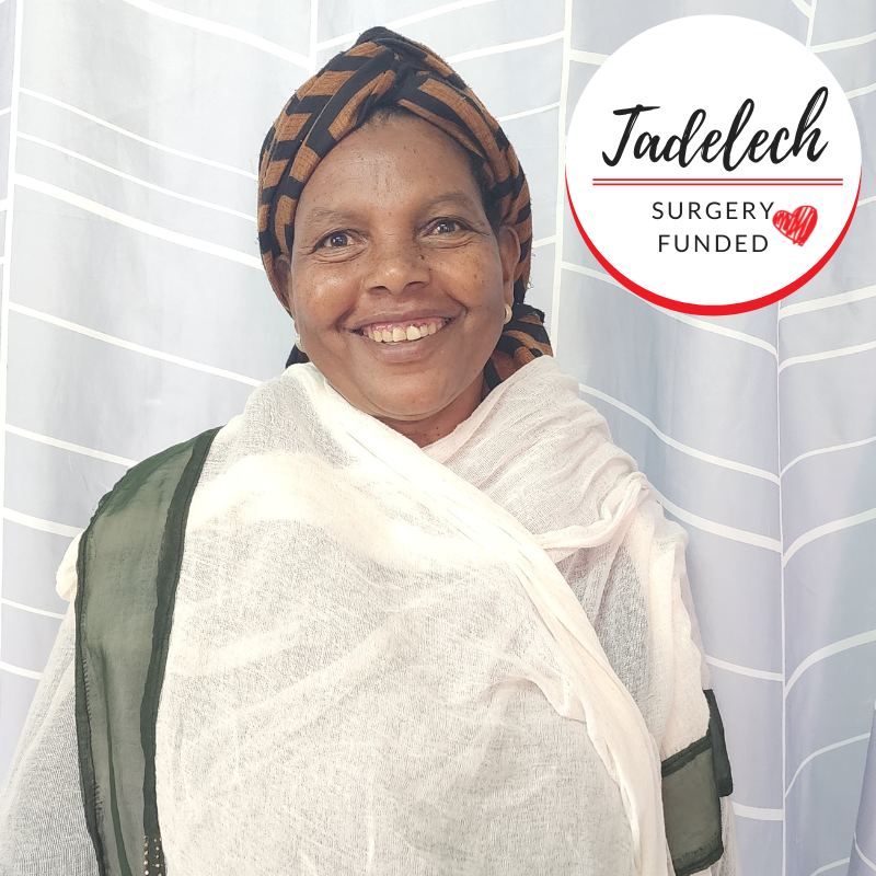 Tadelech