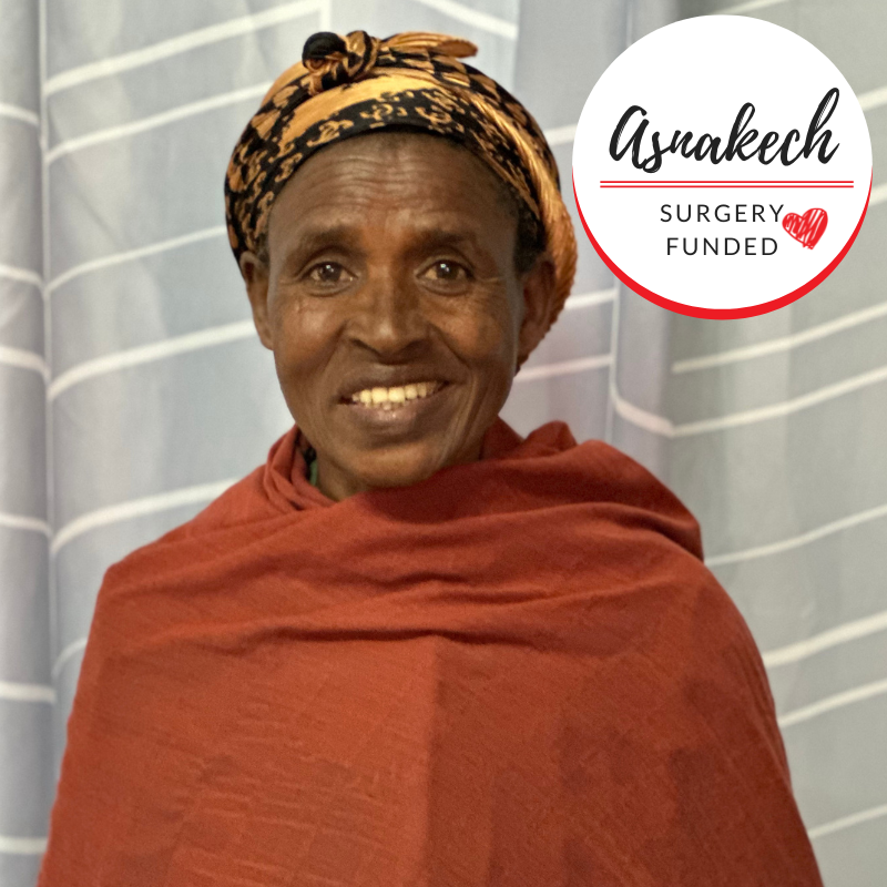 Asnakech
