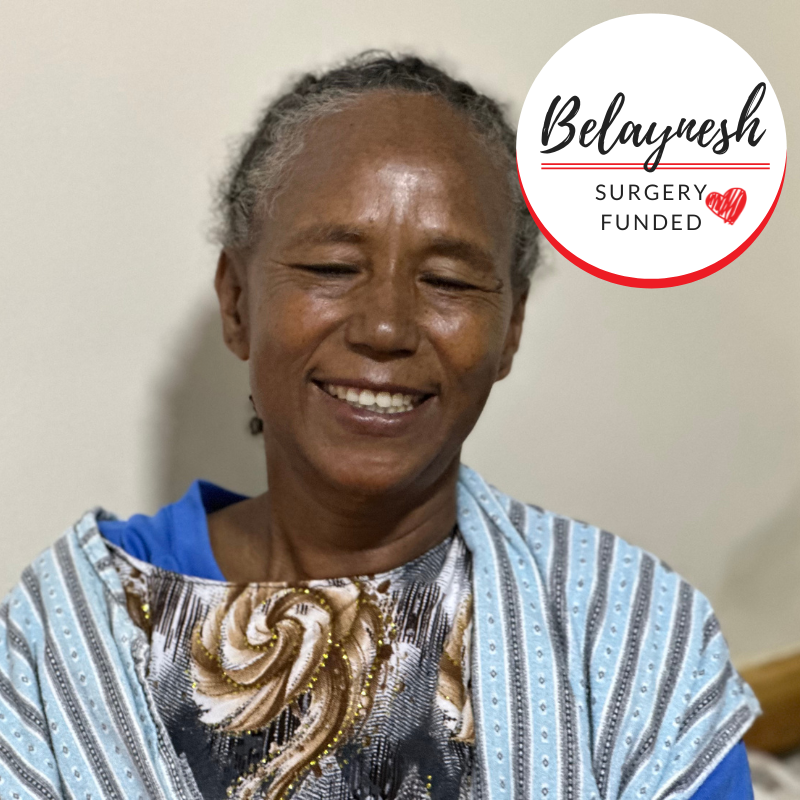 Belaynesh