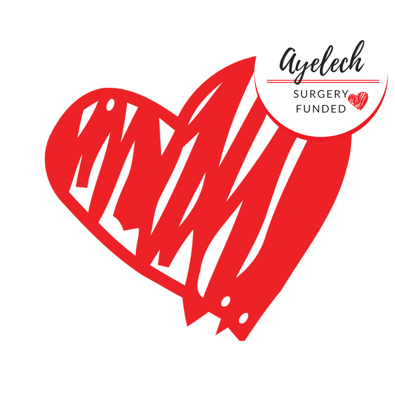Ayelech