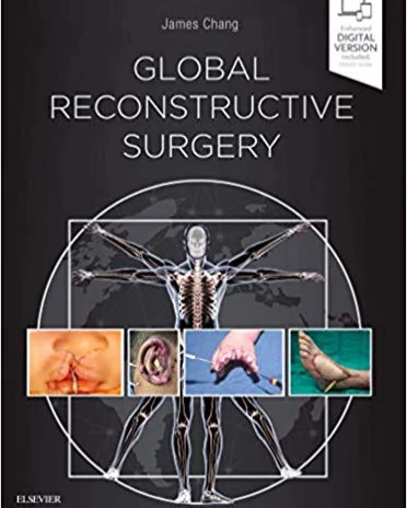 HO Taylor , Sullivan SR . Alveolar Bone Grafting, In: Chang J. ed. Global Reconstructive Surgery . Chapter 3.5: 2018. Elsevier Ltd, London, UK