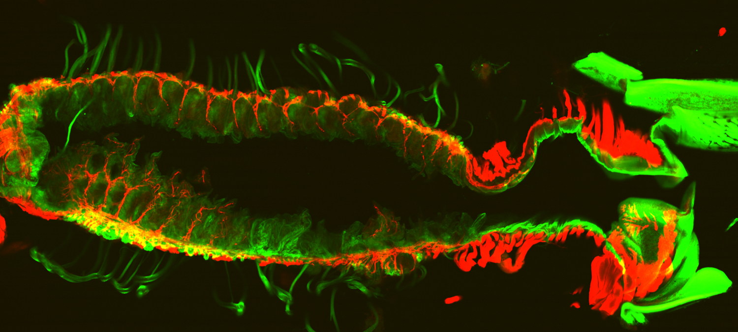 A cross-section of the dragonfly nymph's hindgut.