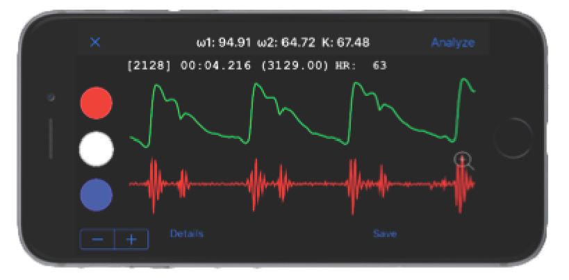 Cardiovascular Health App